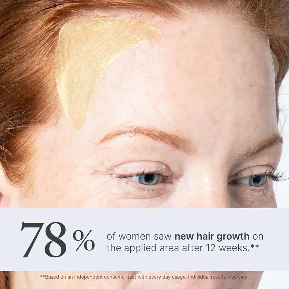 Superpower Thickening Hairpatches - Gold